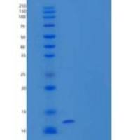 人Podoplanin/PDPN/Aggrus重组蛋白C-Fc