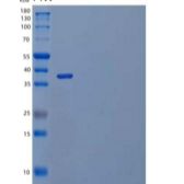 人白介素23受体(IL23R)重组蛋白C-6His