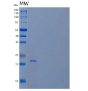 人核仁蛋白家族A成员2/NHP2/NOLA2重组蛋白N-6H