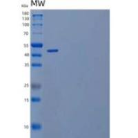 人白介素20受体β(IL20Rb)重组蛋白C-Fc