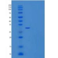 人突触融合蛋白7(STX7)重组蛋白N-6His
