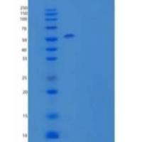 人白细胞介素4受体亚单位α/白细胞介素4受体α重组蛋白C-Fc