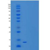人速激肽-3/TAC3重组蛋白N-6His