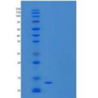 人速激肽-3/TAC3重组蛋白N-6His