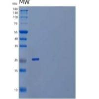 人白介素20受体α(IL20Ra)重组蛋白C-Fc