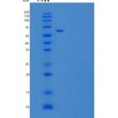 人CD31 / PECAM1重组蛋白