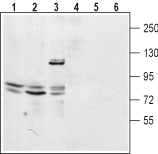Anti-Two Pore Calcium Channel 