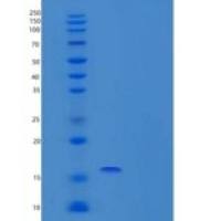 人PI3K相互作用蛋白1/PIK3IP1重组蛋白C-6His