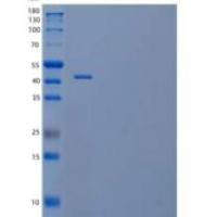 人酪蛋白激酶I亚型γ-2重组蛋白