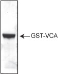 Purity determination of GST-WASP VCA domain