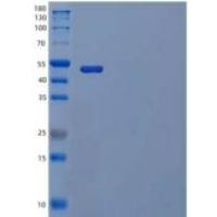 人TREML2/TLT-2重组蛋白C-Fc