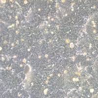 SW948细胞、SW948人结肠癌细胞、SW948细胞