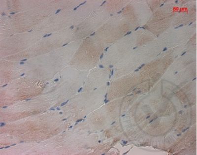 PALB2乳腺癌易感基因相关蛋白2抗体