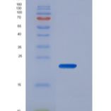 人CD16b / FCGR3B重组蛋白His tag