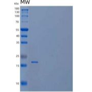 人核仁蛋白家族A成员2/NHP2/NOLA2重组蛋白N-6His