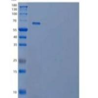 人Cyr61/CCN1重组蛋白C-Fc