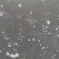 宫颈上皮细胞/免疫荧光鉴定/镜像绮点(Cellverse)