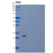 人细小病毒14/PIN4重组蛋白N-6His