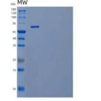 小鼠白介素23受体(IL23R)重组蛋白C-Fc