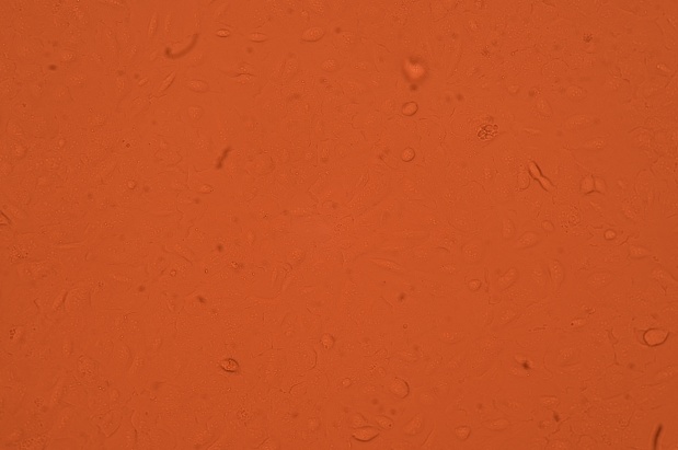 U-2 OS（U-2OS，U2OS），人骨肉瘤细胞产品信息