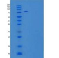 人环岛同系物4重组蛋白