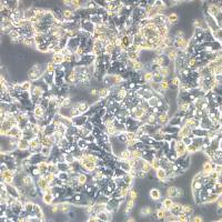 Hep G2.2.15细胞、Hep G2.2.15人肝癌细胞、人肝癌细胞