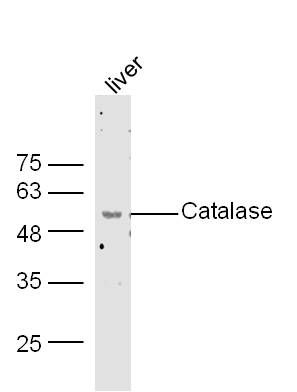 Catalase过氧化氢酶抗体