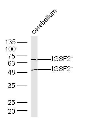 IGSF21 antibody