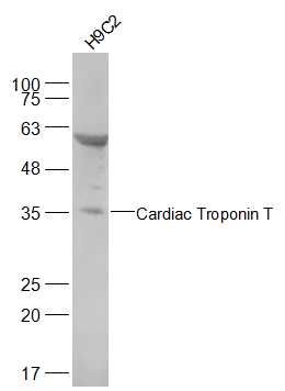 Cardiac Troponin T心肌特异性肌钙蛋白T抗体