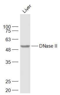 DNase II antibody