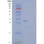 人神经外营养蛋白1(NXPH1)重组蛋白C-6His