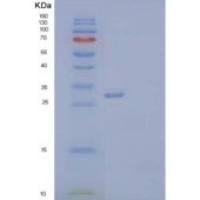 人神经外营养蛋白1(NXPH1)重组蛋白C-6His