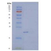 人超氧化物歧化酶（SOD2/Mn-SOD）重组蛋白N-6His
