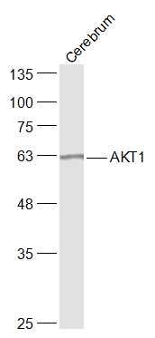 AKT1蛋白激酶B抗体