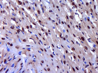 Phospho-Histone H2A.X (Tyr143)