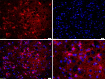 肌营养不良蛋白抗体 Dystrophin antibody