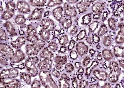 Histone H3 (acetyl K27) antibo