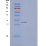 人CGREF1/CGR11重组蛋白C-6His