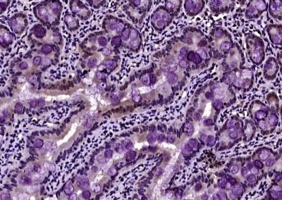 Phospho-Histone H3 (Thr11) ant