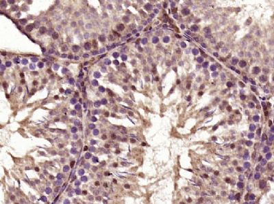 C5orf24 5号染色体开放阅读框24抗体
