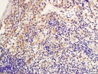 IL-2白介素2抗体