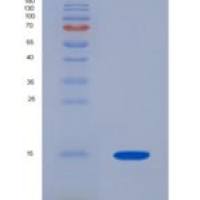 人酰基磷酸酶2(ACYP2)重组蛋白