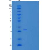 小鼠RANK/TNFRSF11A重组蛋白C-6His