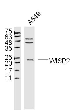 WISP2 antibody