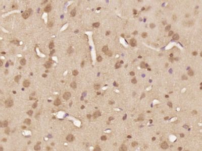 phospho-FOXO4 (Thr451) antibod