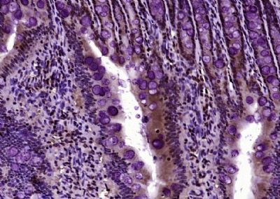 Histone H3 (acetyl K27) antibo