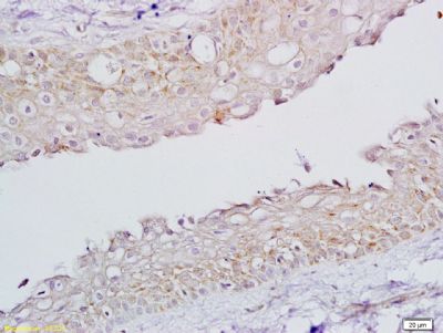 FSH receptor促卵泡刺激素受体抗体