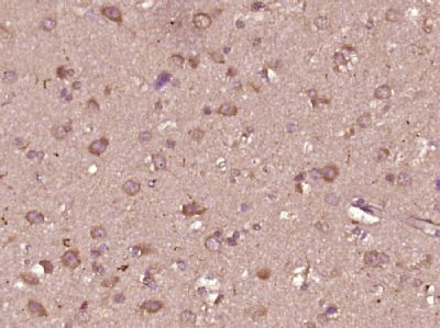 caspase-3 p17 subunit antibody