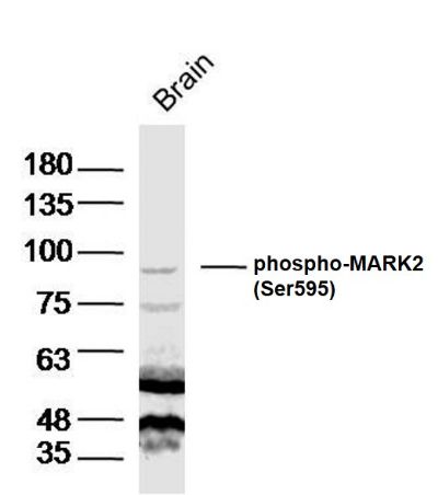 phospho-MARK2(Thr596)磷酸化丝氨酸/苏氨