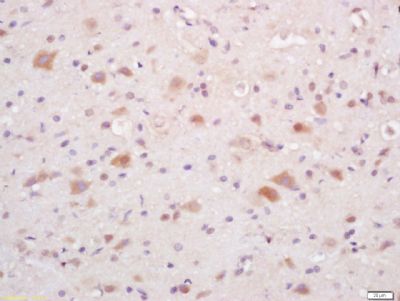 Phospho-P38 MAPK (Thr180 + Tyr